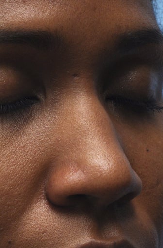 Non-Surgical Nose Job before 454046