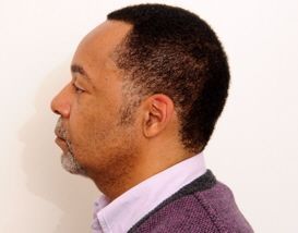 Liposuction of the Chin 380071