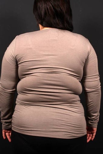 Bra Line Back Lift 472813