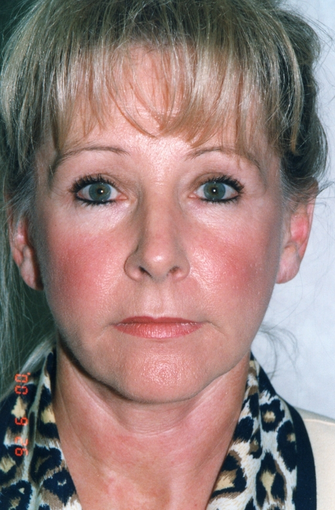 Skin Care after 531622