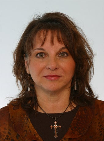 Juvederm Radiesse before 260323