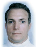 Hair Transplant after 426686
