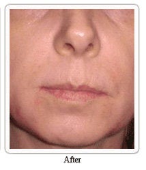 Evolence: a naturally younger-looking you after 54975