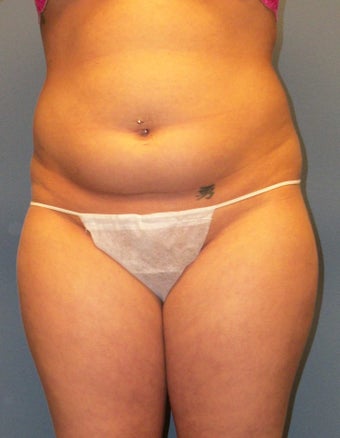 Aqualipo 449807