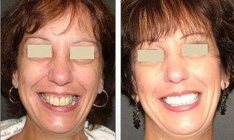 Cosmetic Dentistry before 143013