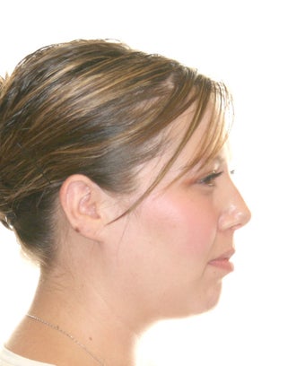 Surgical Orthodontics 344747
