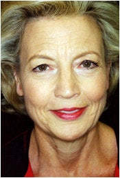 Facelift, Endoscopic Forehead Lift, Quadrilateral Blepharoplasty before 205341
