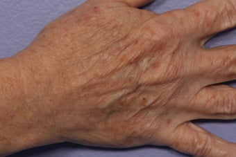 IPL Limelight to Hands 309737