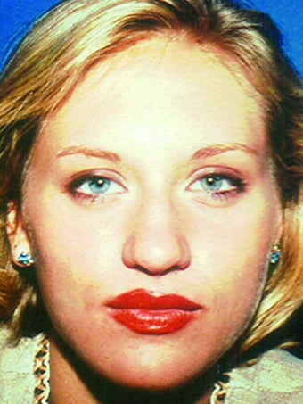 Rhinoplasty with sculpting of nasal tip and dorsum, and correction of nasal over-projection. before 249042