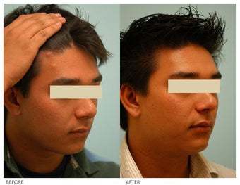 Facial Reconstruction before 136839