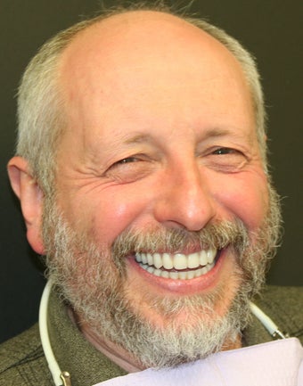 Full mouth reconstruction with dental implants after 364517