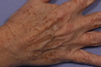 IPL Limelight to Hands 309737