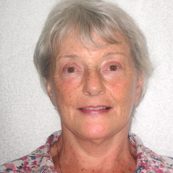65-74 year old woman treated with Lower Face Lift after 3602878