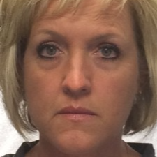 45-54 year old woman treated with Restylane before 3200840