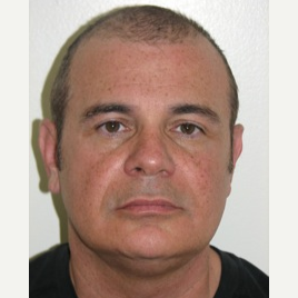 35-44 year old man treated with Non Surgical Face Lift before 3137274