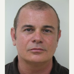 35-44 year old man treated with Non Surgical Face Lift after 3137274
