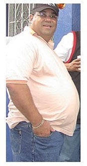 58 years old male, treated with gastric bypass before 1239573