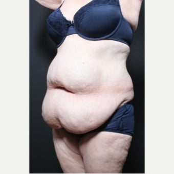 45-54 year old woman treated with Weight Loss 1957227