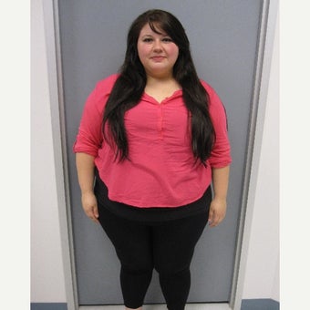 25-34 year old woman treated with Sleeve Gastrectomy before 2562263