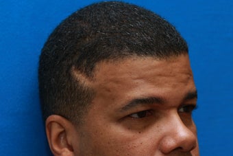 Young Man with Heavy Forehead and Temple Scar before 1419409