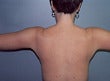 42 year old female patient after 927042