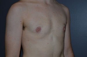 FTM TRANSGENDER after 1227469