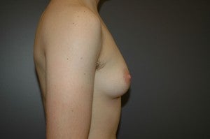 FTM TRANSGENDER 1227469