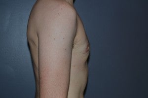 FTM TRANSGENDER 1227469