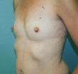 35 year old female patient 944365