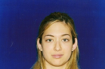 Rhinoplasty before 229773