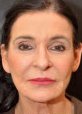 65 year old white female following 3 sessions of Sculptra for facial skin tightening after 1427597