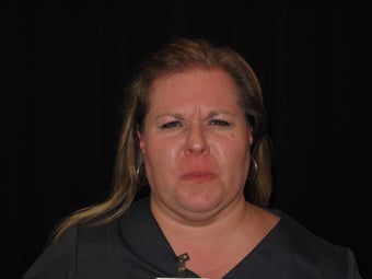 42 year old female for frown lines before 1389552