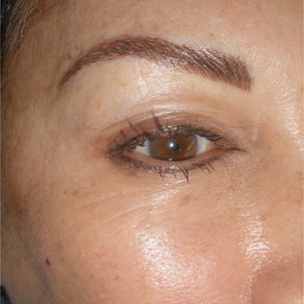 35-44 year old woman treated with Permanent Makeup after 2753794