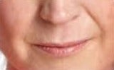 55-64 year old woman treated with Lip Augmentation before 2986797