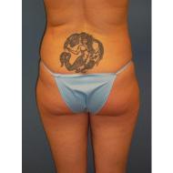 Buttock Accentuation before 1172423