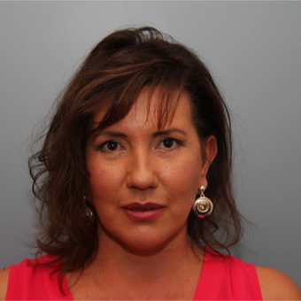 Eyelid Surgery was performed on both her upper and lower eyelids after 3408273