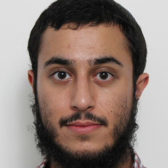 18-24 year old man treated with Rhinoplasty after 3448597