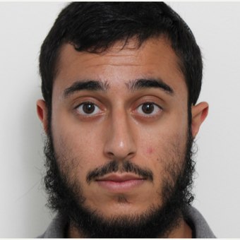 18-24 year old man treated with Rhinoplasty before 3448597