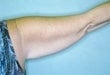 55 year old female patient 926472