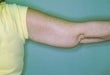 55 year old female patient 926472