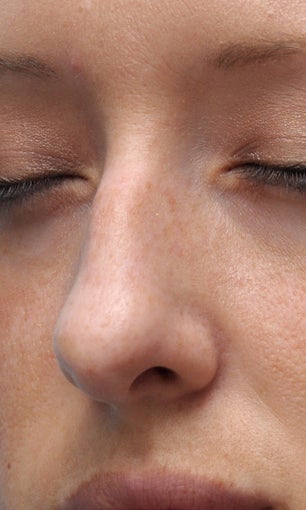 Facial Dermafillers 1046913
