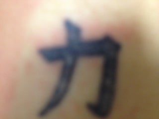 Chinese Character before and after two Picosure Treatments before 1042605