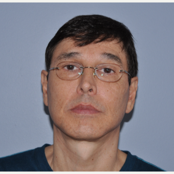 55-64 year old man treated with Facelift after 3603850