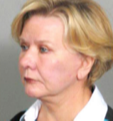 65 year old woman treated with Facelift after 3282916