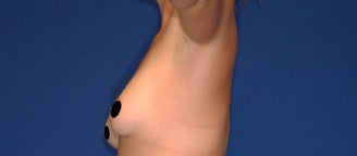 30 yo female desires larger natural breasts 1129984