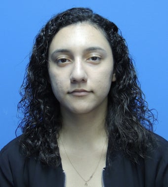 18-24 year old woman treated with Rhinoplasty before 3704515