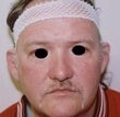 Male patient who underwent ear surgery before 931746
