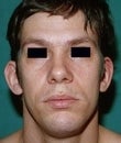 32 year old male patient before 934495