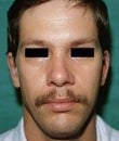 32 year old male patient after 934495