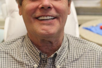 All-on-4 Dental Implants after 1288250
